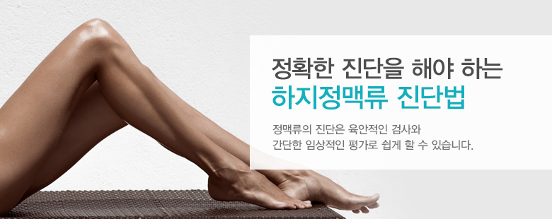 정확한 진단을 해야 하는 하지정맥류 진단법