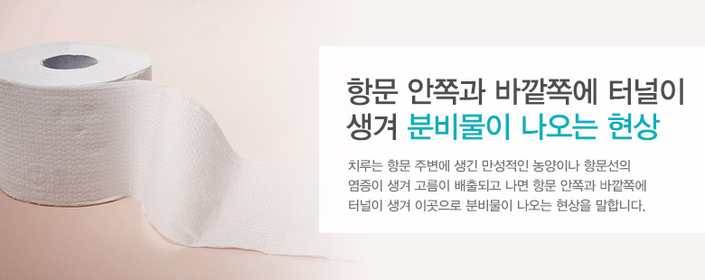 항문 안쪽과 바깥쪽에 터널이 생겨 분비물이 나오는 현상